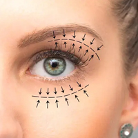 بلفاروپلاستی دکتر فرشته شیخ الاسلامی